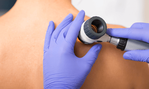 Dermatologo Piove di Sacco